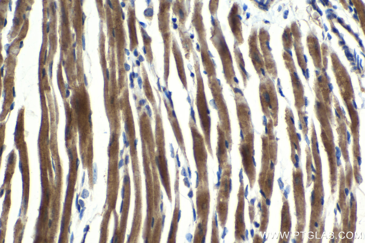 Immunohistochemical analysis of paraffin-embedded mouse heart tissue slide using KHC2095 (TRAK2 IHC Kit).