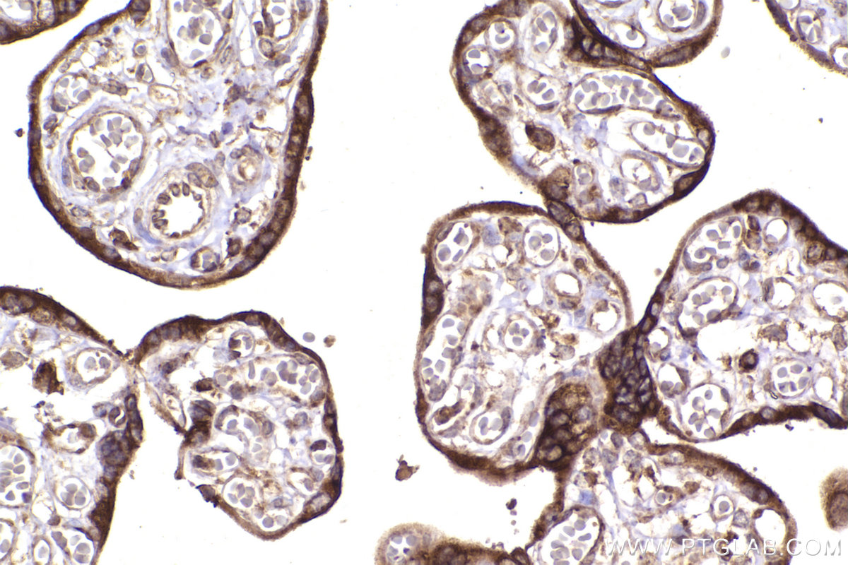 Immunohistochemical analysis of paraffin-embedded human placenta tissue slide using KHC2264 (TRAPA/SSR1 IHC Kit).