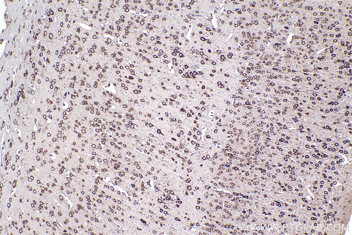 Immunohistochemical analysis of paraffin-embedded mouse brain tissue slide using KHC2264 (TRAPA/SSR1 IHC Kit).