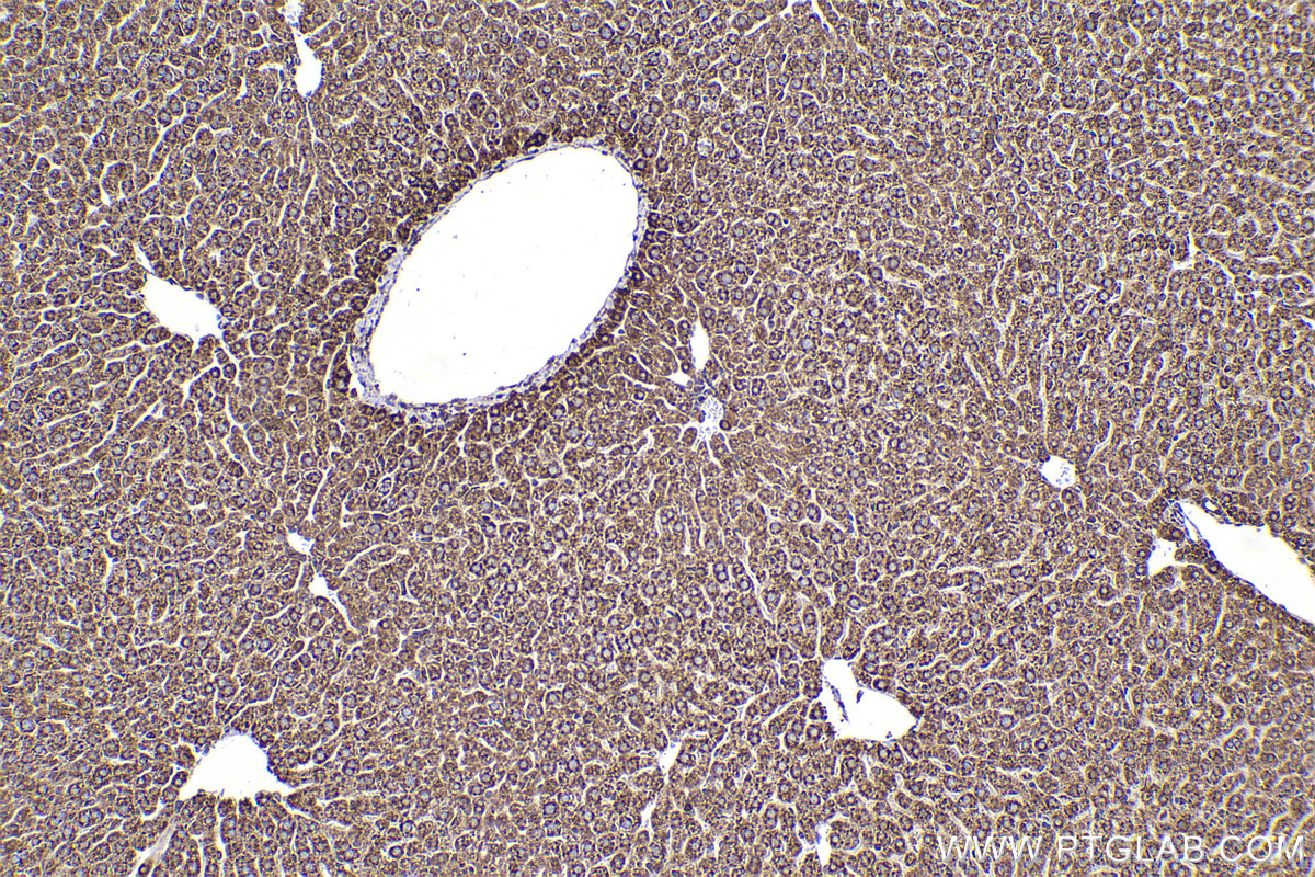 Immunohistochemical analysis of paraffin-embedded mouse liver tissue slide using KHC2264 (TRAPA/SSR1 IHC Kit).