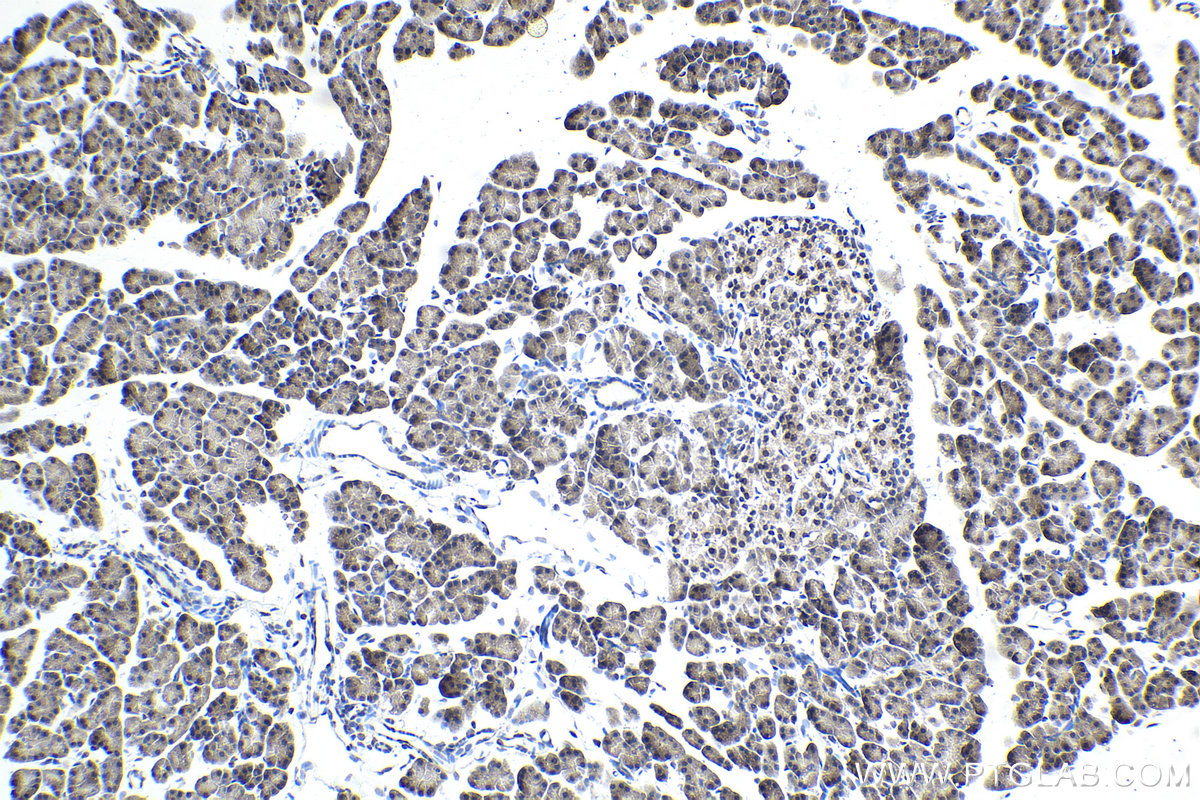 Immunohistochemical analysis of paraffin-embedded rat pancreas tissue slide using KHC1729 (TRIM25 IHC Kit).