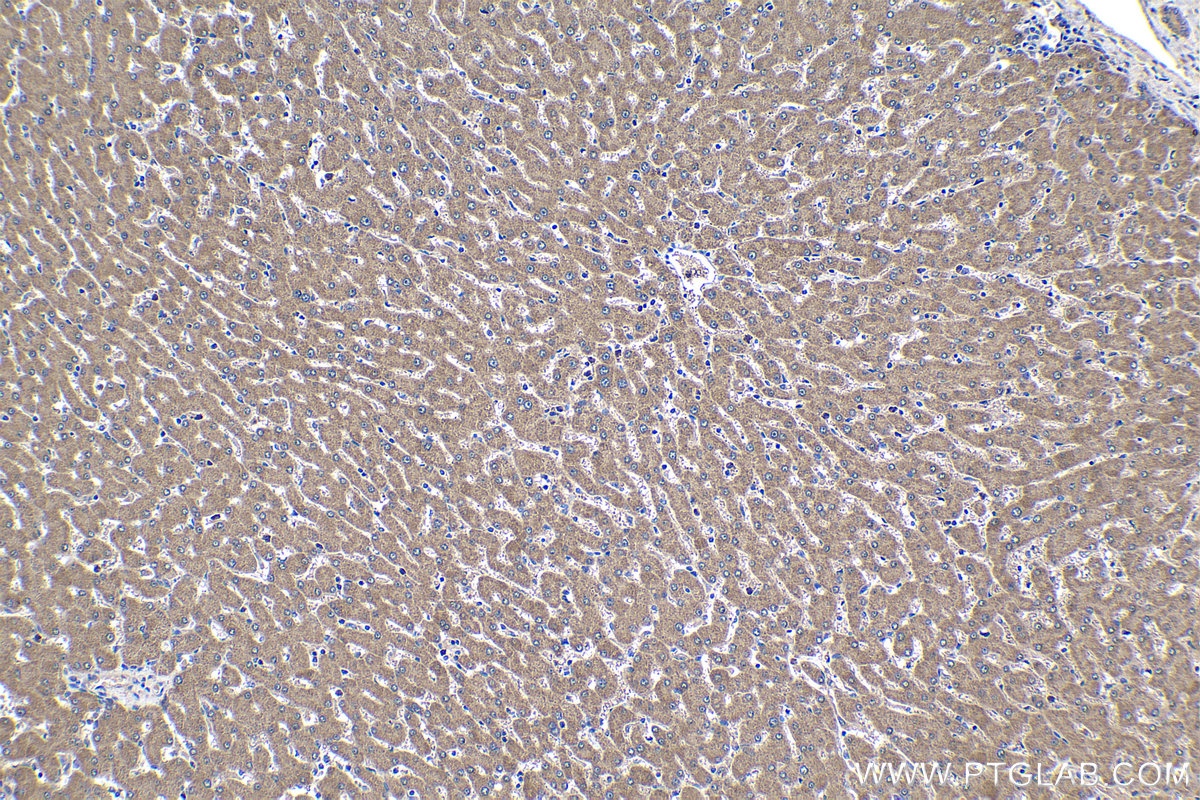 Immunohistochemical analysis of paraffin-embedded human liver tissue slide using KHC1173 (TRIM59 IHC Kit).