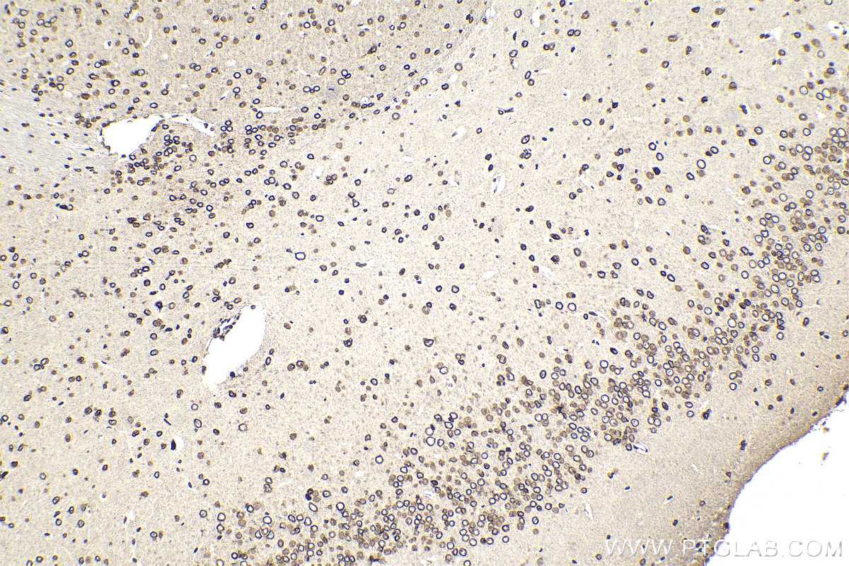 Immunohistochemical analysis of paraffin-embedded mouse brain tissue slide using KHC2125 (TRIO IHC Kit).