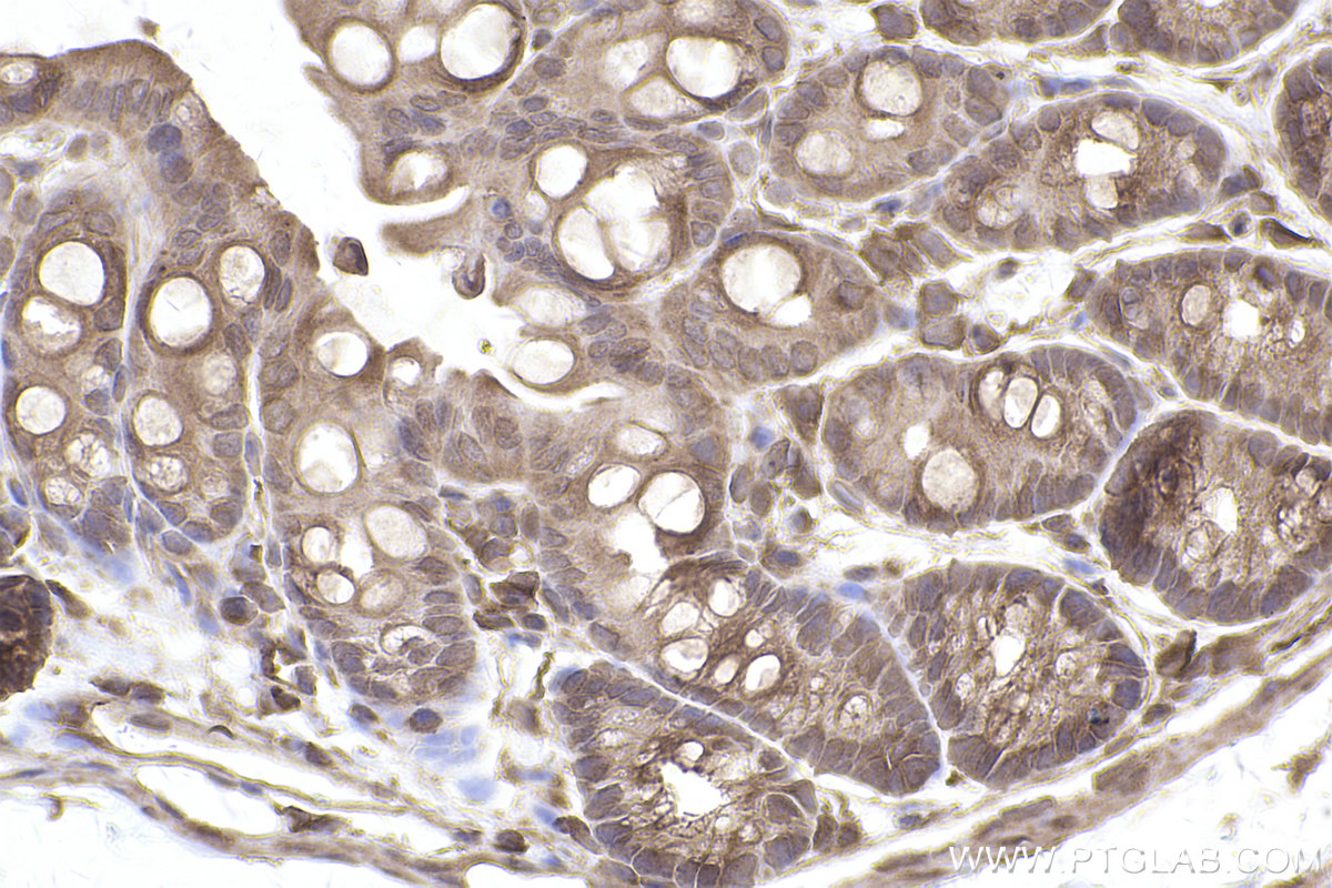 Immunohistochemical analysis of paraffin-embedded mouse colon tissue slide using KHC2493 (TRIP10 IHC Kit).