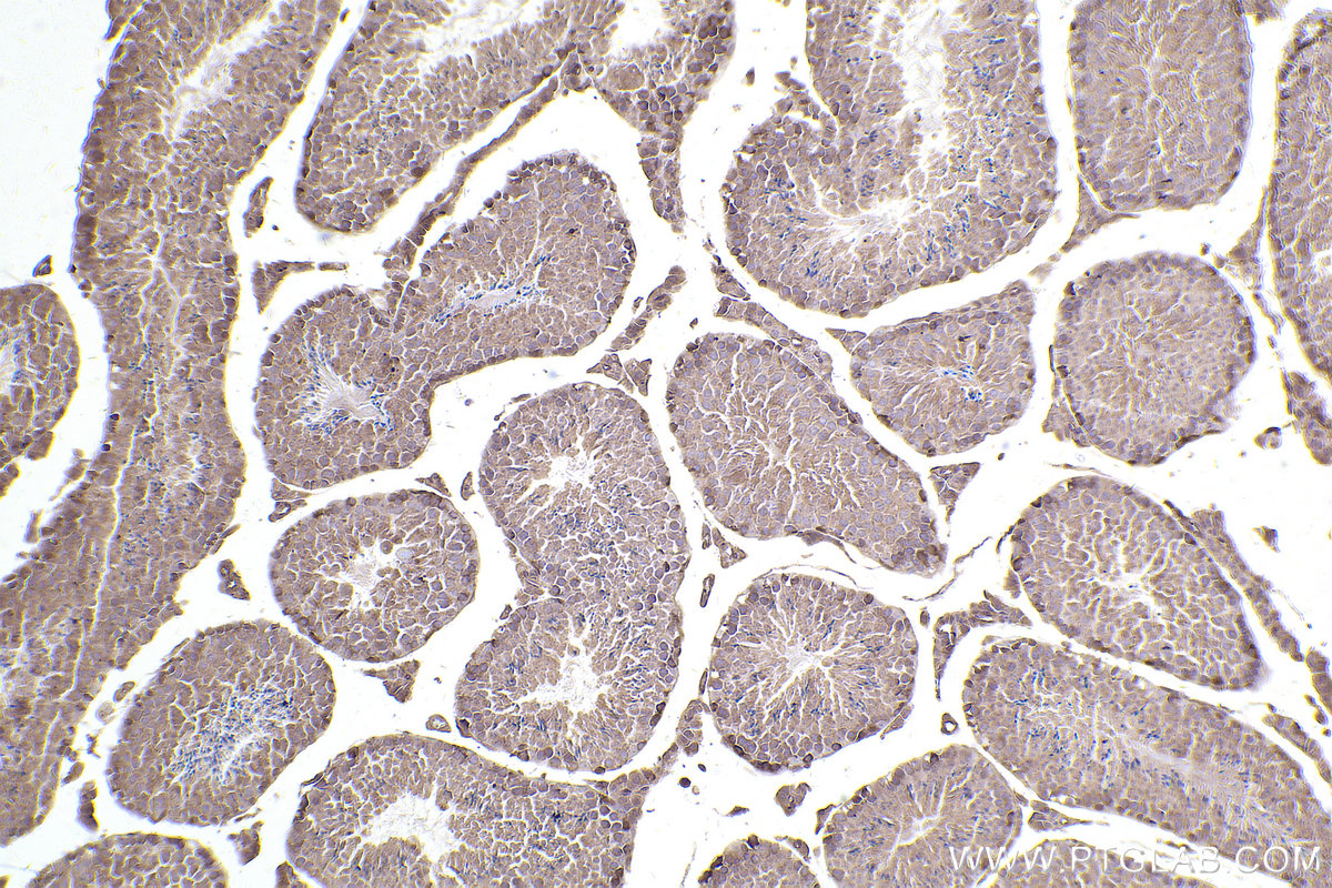 Immunohistochemical analysis of paraffin-embedded mouse testis tissue slide using KHC2493 (TRIP10 IHC Kit).