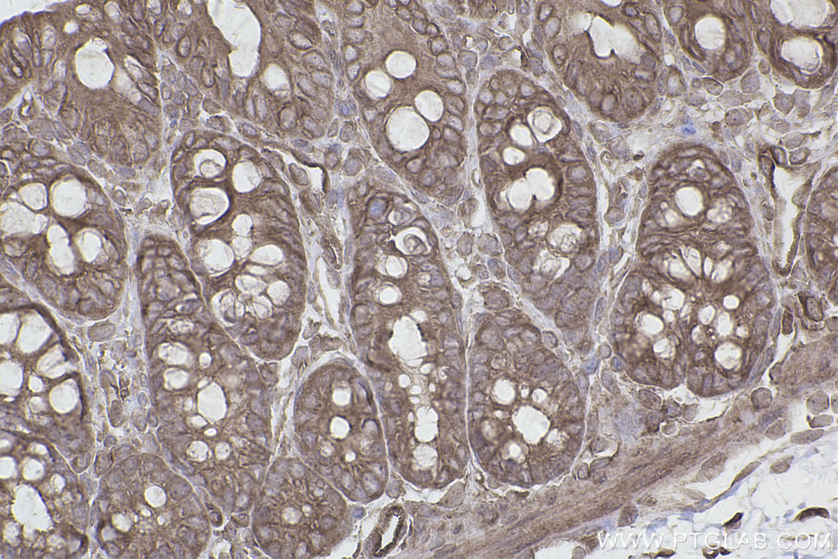 Immunohistochemical analysis of paraffin-embedded rat colon tissue slide using KHC2493 (TRIP10 IHC Kit).