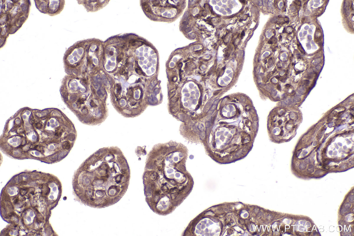 Immunohistochemical analysis of paraffin-embedded human placenta tissue slide using KHC2493 (TRIP10 IHC Kit).