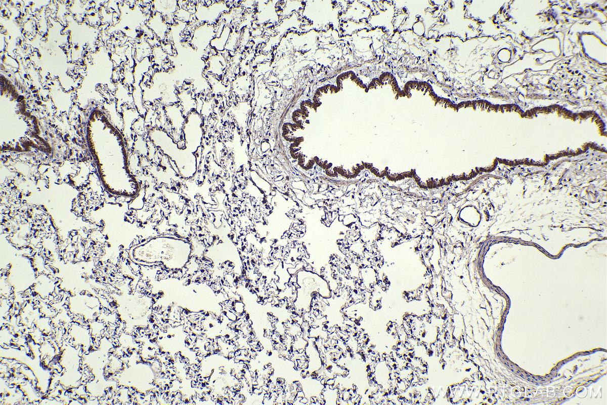 Immunohistochemical analysis of paraffin-embedded rat lung tissue slide using KHC2348 (TSC2 IHC Kit).