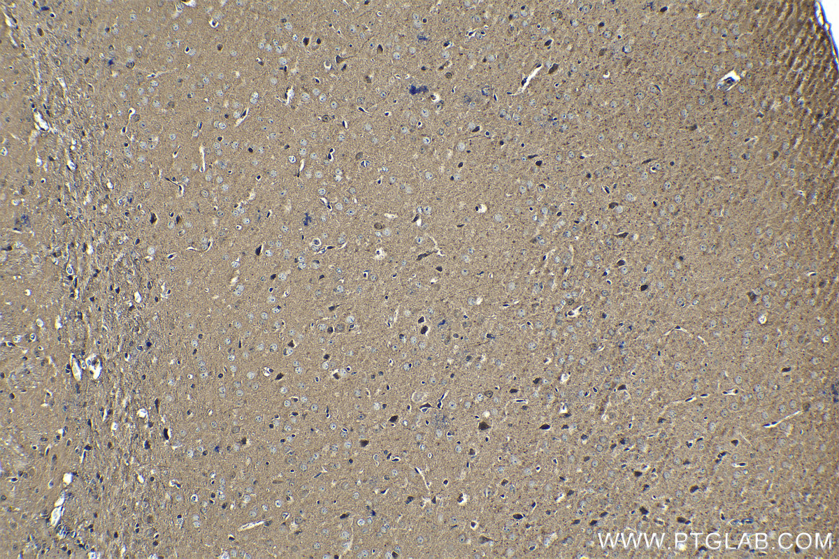 Immunohistochemical analysis of paraffin-embedded mouse brain tissue slide using KHC1341 (TSC22D1 IHC Kit).