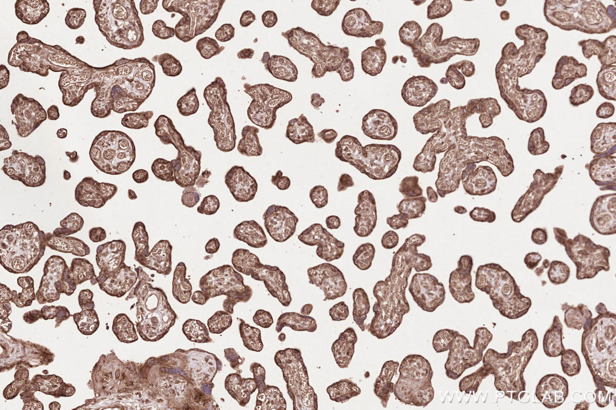 Immunohistochemical analysis of paraffin-embedded human placenta tissue slide using KHC2582 (TTBK2 IHC Kit).