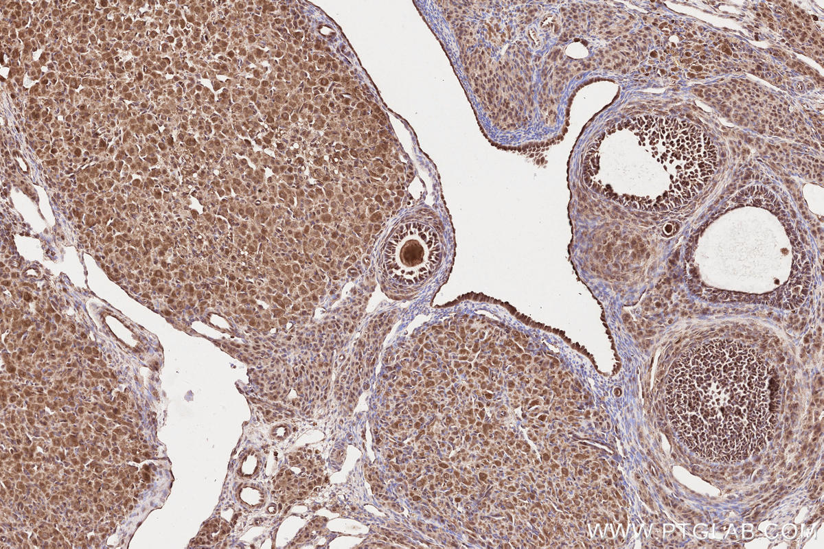 Immunohistochemical analysis of paraffin-embedded rat ovary tissue slide using KHC2582 (TTBK2 IHC Kit).