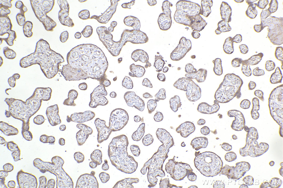 Immunohistochemical analysis of paraffin-embedded human placenta tissue slide using KHC2222 (TYK2 IHC Kit).