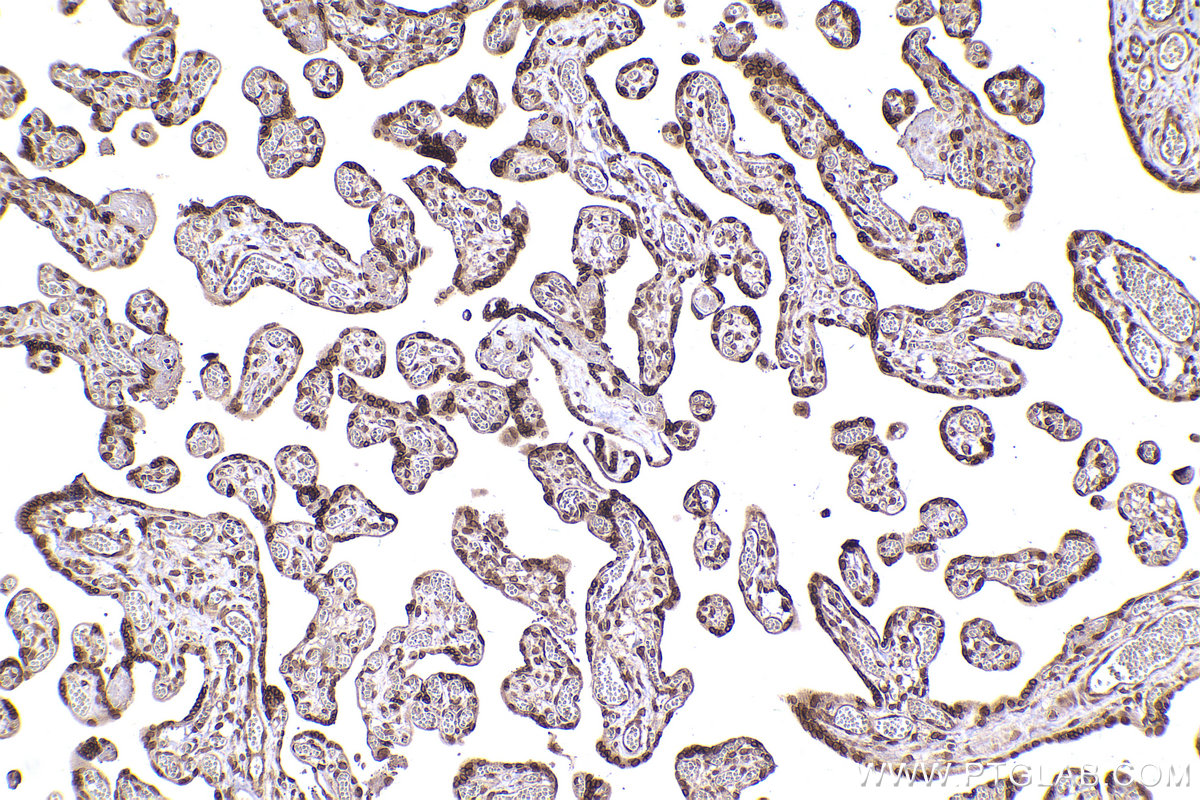 Immunohistochemical analysis of paraffin-embedded human placenta tissue slide using KHC2460 (UBE2V1 IHC Kit).