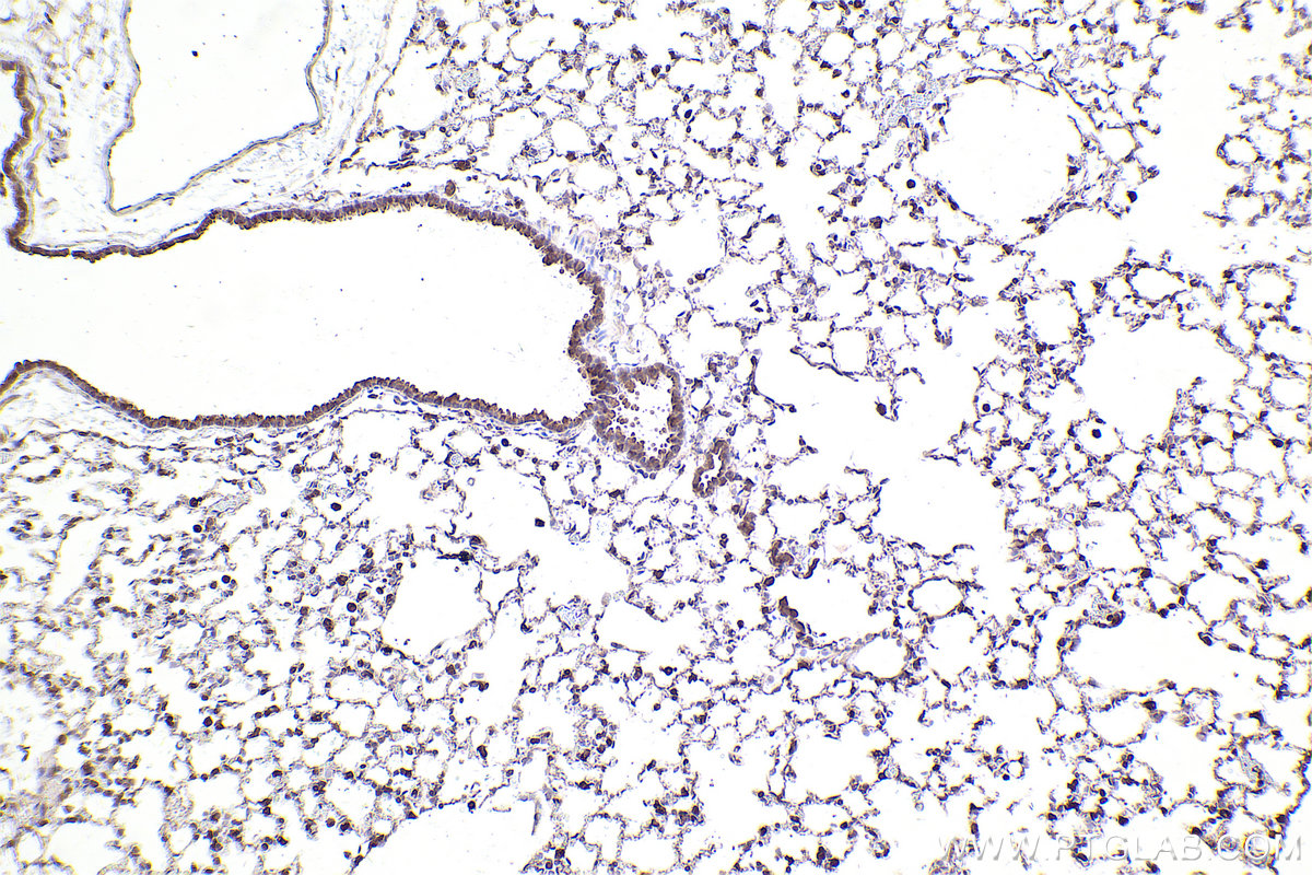 Immunohistochemical analysis of paraffin-embedded mouse lung tissue slide using KHC2554 (UBR4 IHC Kit).