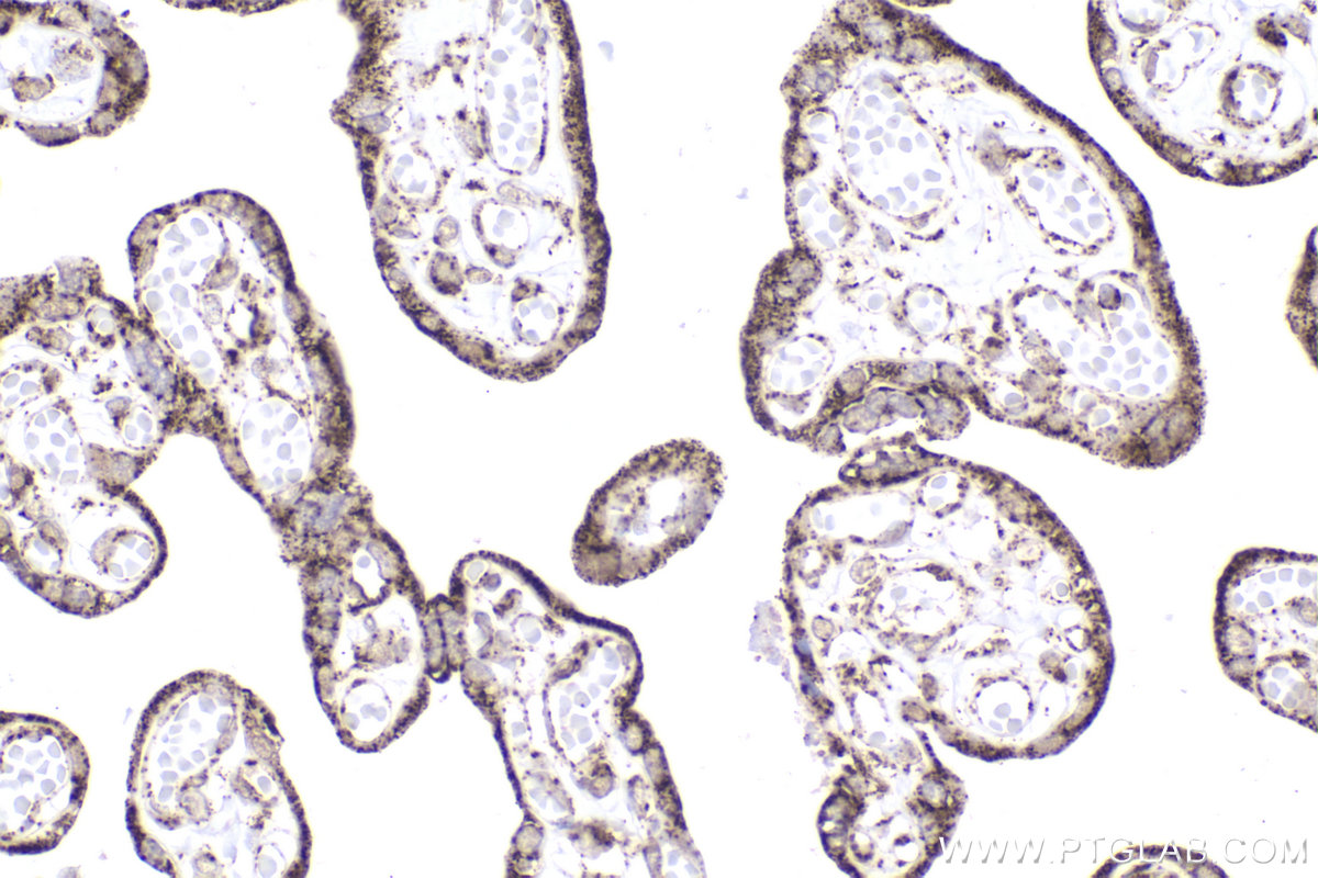 Immunohistochemical analysis of paraffin-embedded human placenta tissue slide using KHC2235 (UQCRC1 IHC Kit).