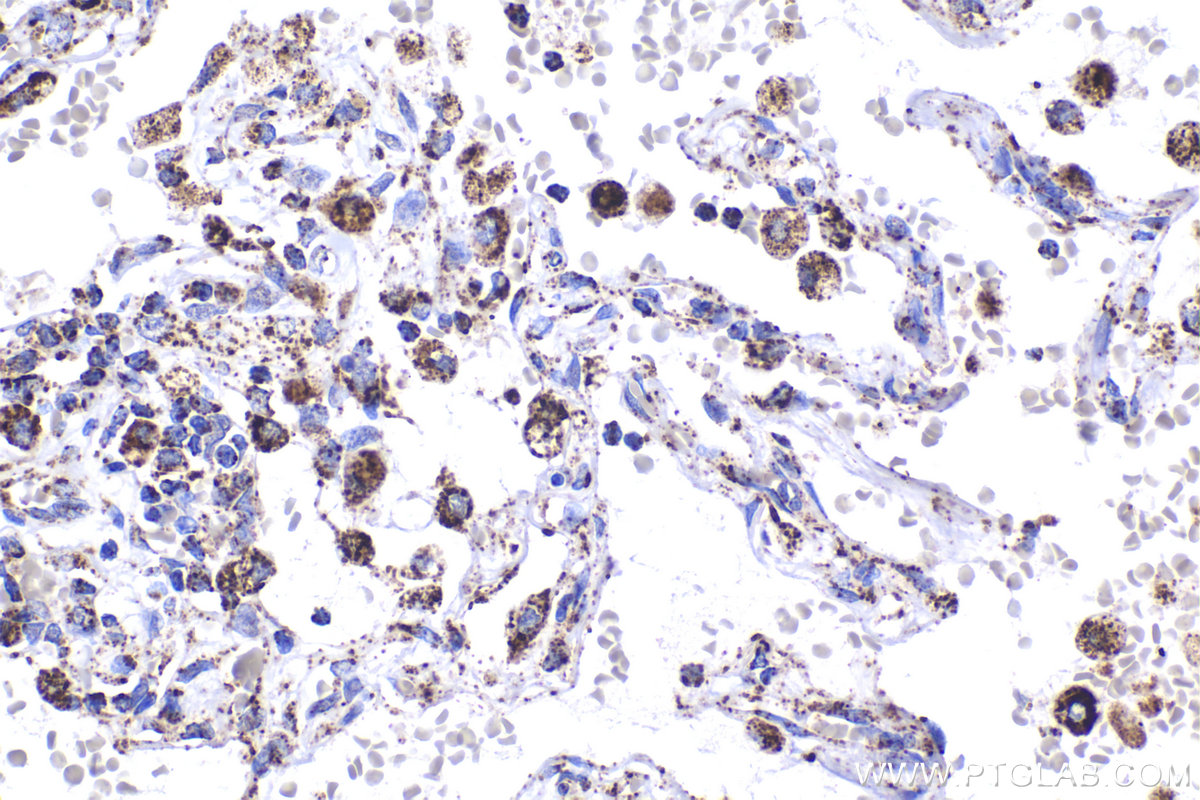 Immunohistochemical analysis of paraffin-embedded human lung tissue slide using KHC2235 (UQCRC1 IHC Kit).