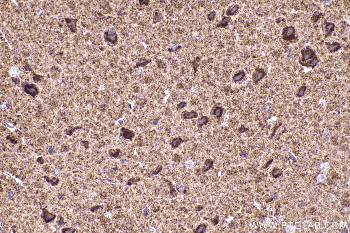 Immunohistochemical analysis of paraffin-embedded mouse brain tissue slide using KHC2235 (UQCRC1 IHC Kit).