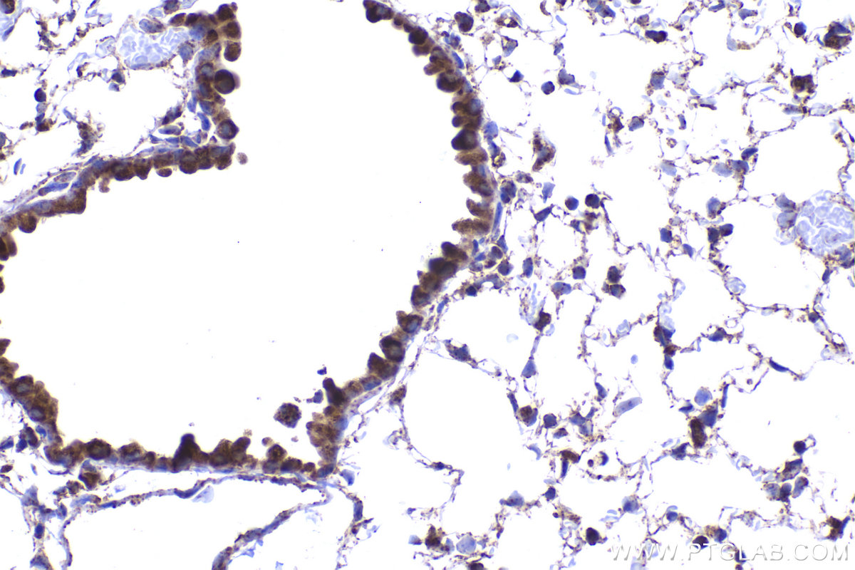 Immunohistochemical analysis of paraffin-embedded mouse lung tissue slide using KHC2235 (UQCRC1 IHC Kit).