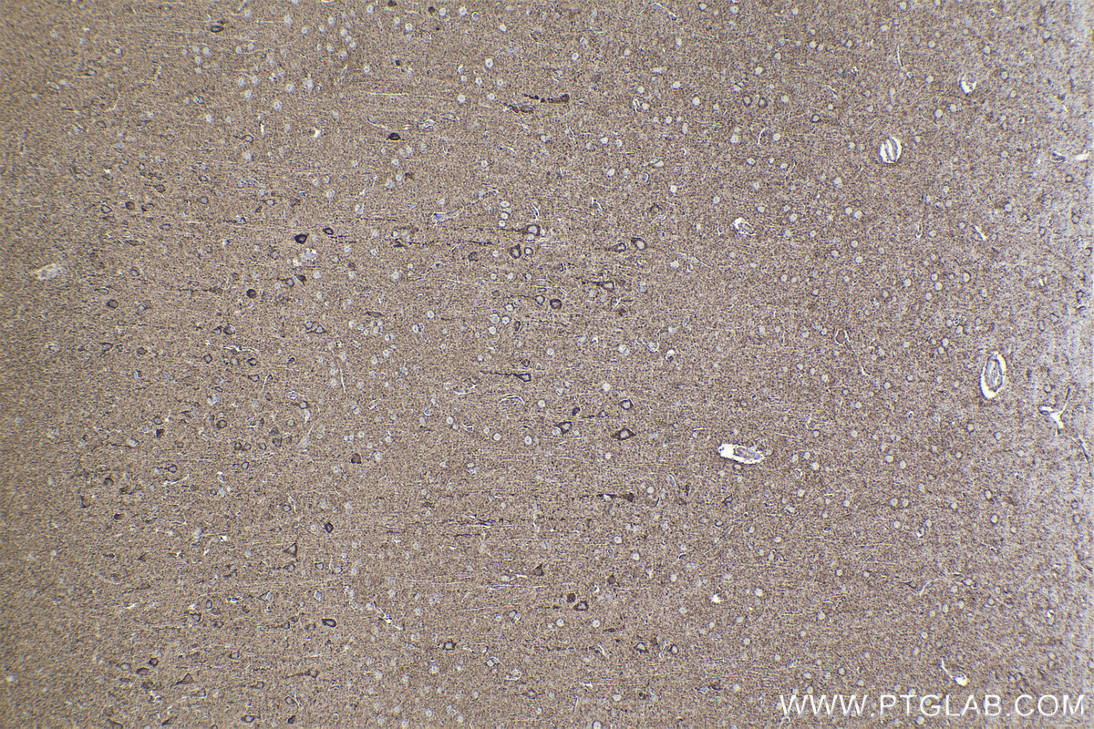 Immunohistochemical analysis of paraffin-embedded rat brain tissue slide using KHC2235 (UQCRC1 IHC Kit).