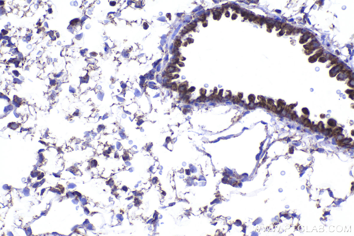 Immunohistochemical analysis of paraffin-embedded rat lung tissue slide using KHC2235 (UQCRC1 IHC Kit).