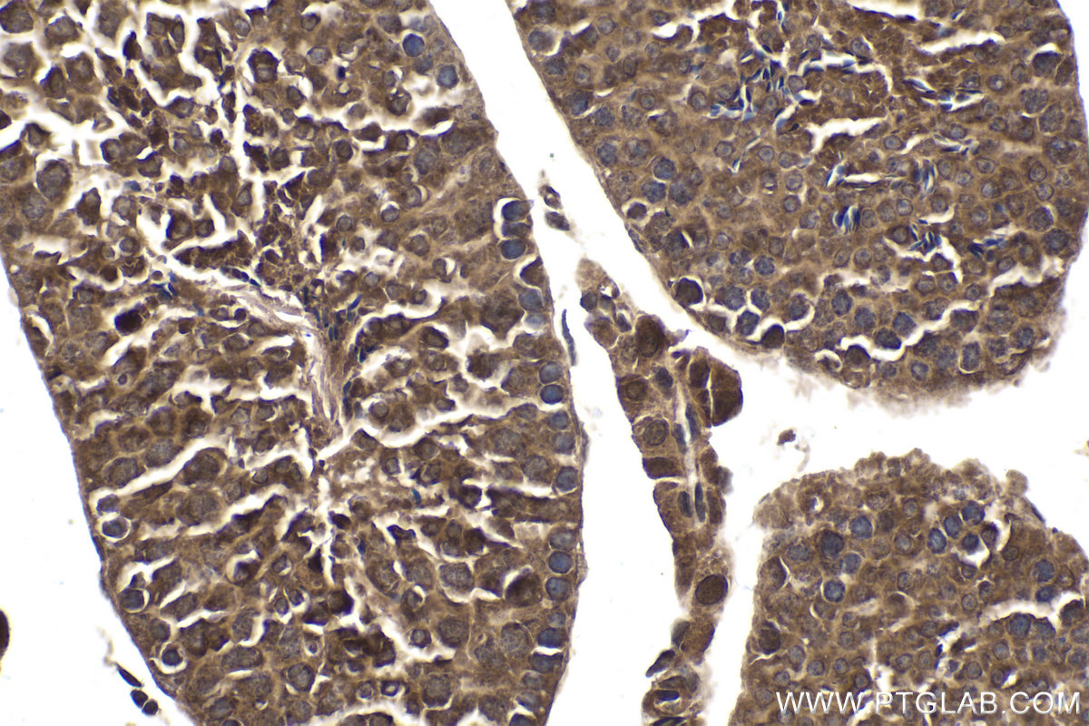 Immunohistochemical analysis of paraffin-embedded mouse testis tissue slide using KHC1770 (USH1G IHC Kit).