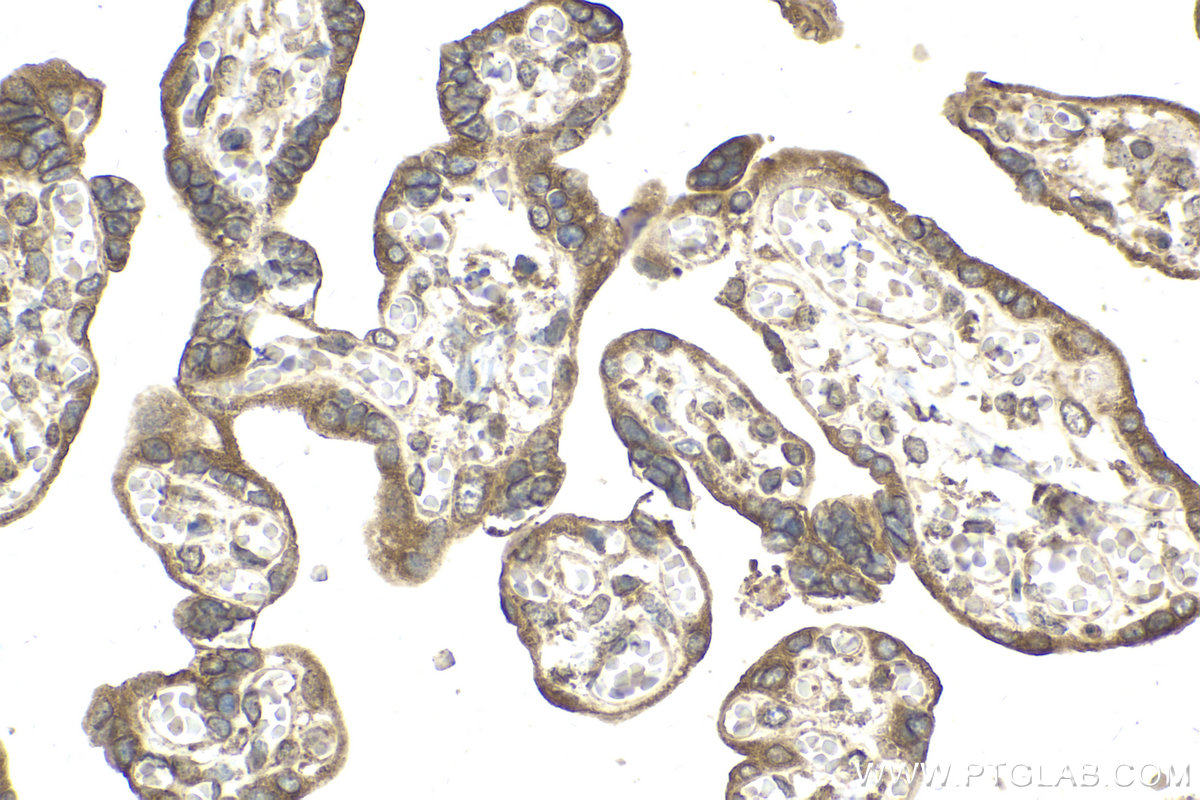 Immunohistochemical analysis of paraffin-embedded human placenta tissue slide using KHC2142 (VAPB IHC Kit).