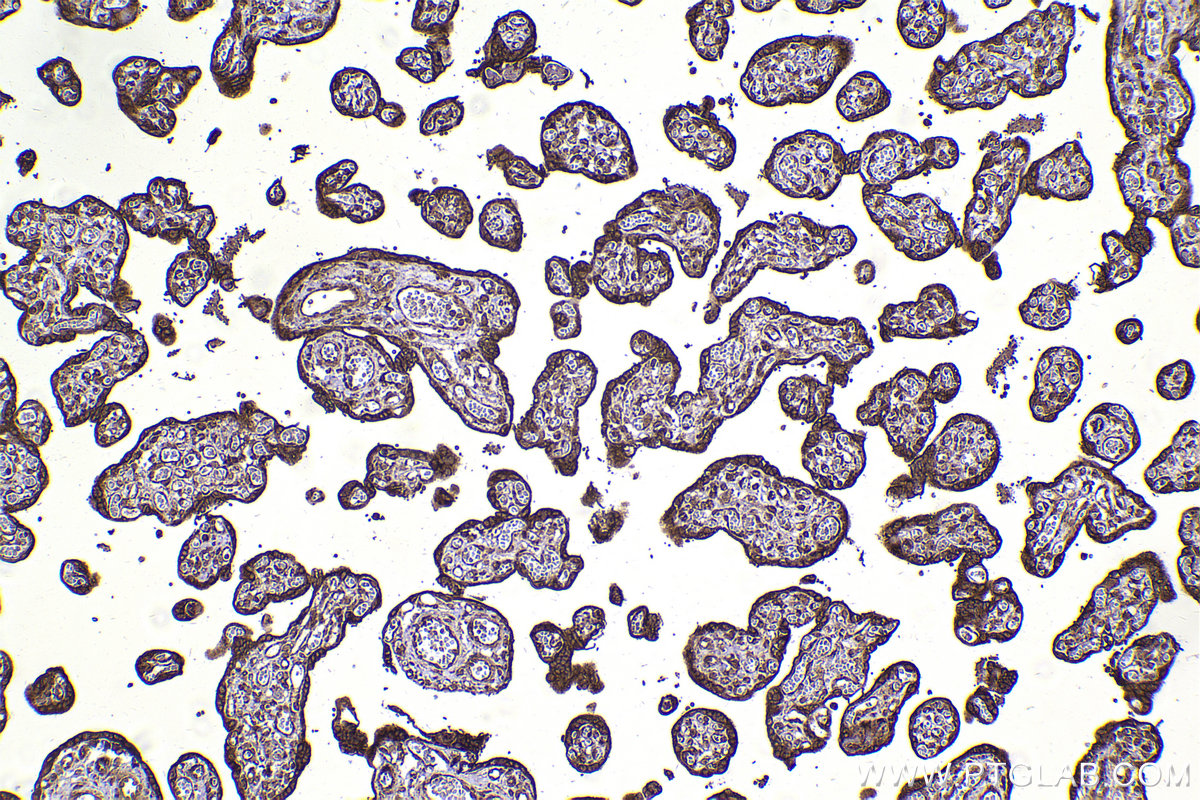 Immunohistochemical analysis of paraffin-embedded human placenta tissue slide using KHC2265 (VDAC2 IHC Kit).