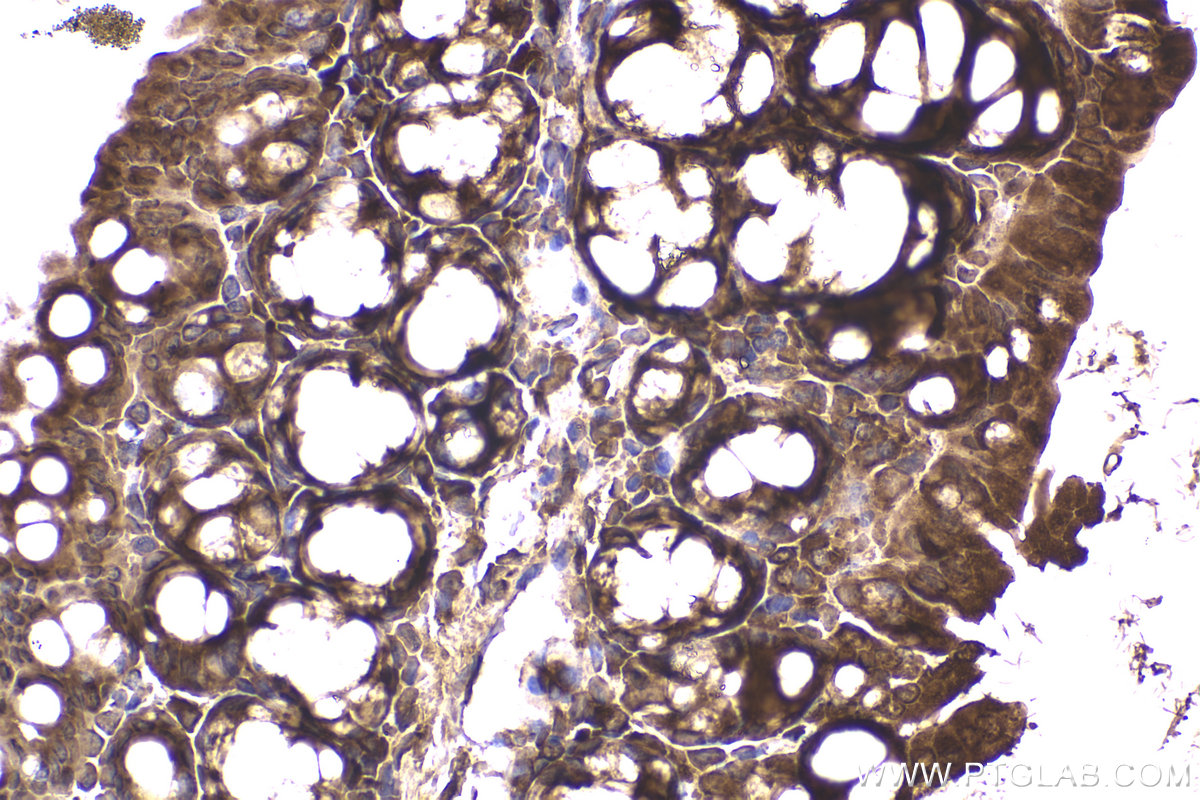 Immunohistochemical analysis of paraffin-embedded mouse small intestine tissue slide using KHC2265 (VDAC2 IHC Kit).