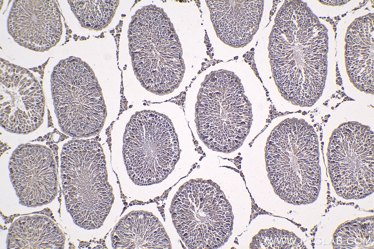 Immunohistochemical analysis of paraffin-embedded rat testis tissue slide using KHC1809 (VPS36 IHC Kit).