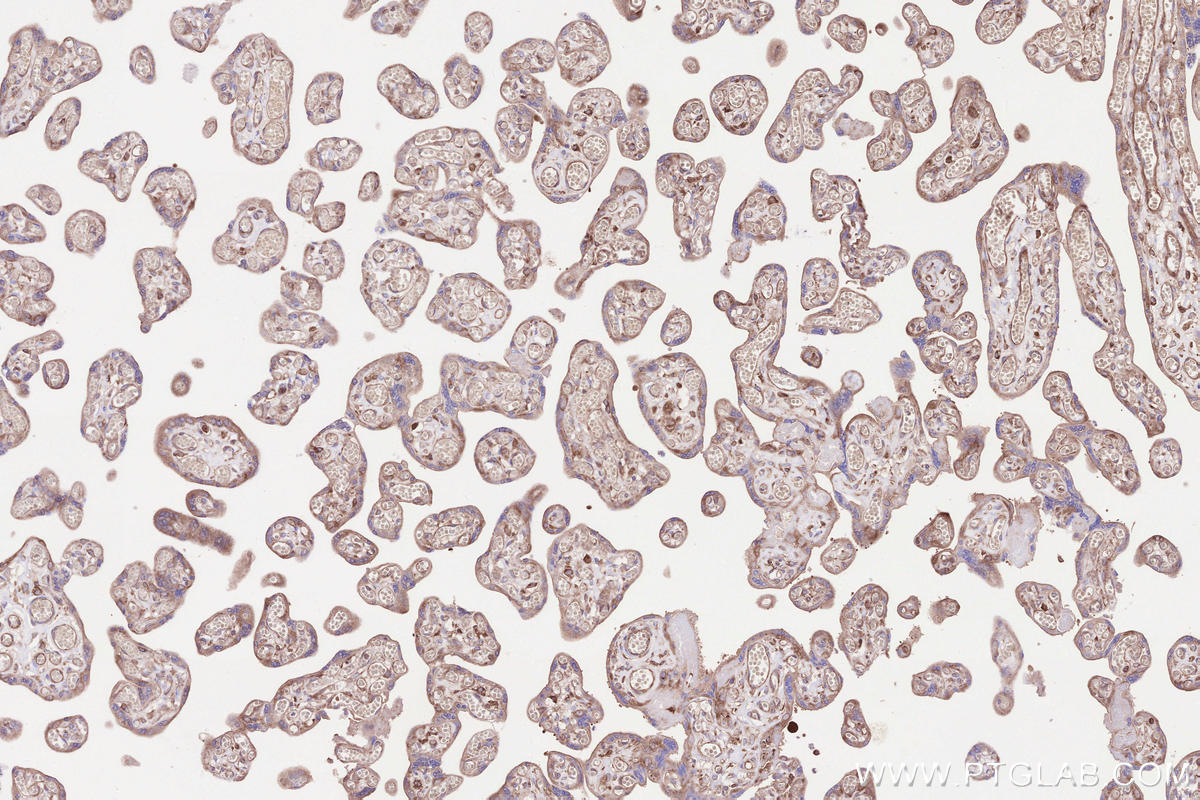 Immunohistochemical analysis of paraffin-embedded human placenta tissue slide using KHC2560 (VPS53 IHC Kit).