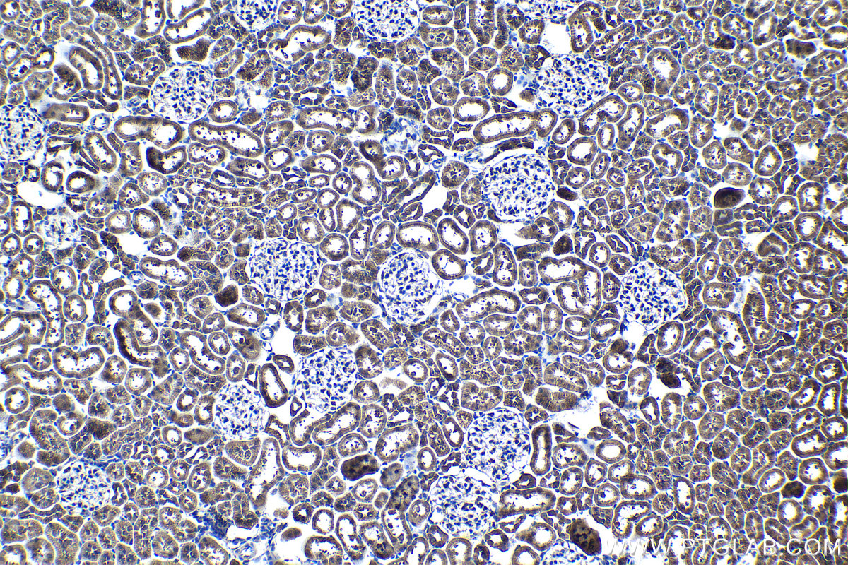 Immunohistochemical analysis of paraffin-embedded rat kidney tissue slide using KHC1224 (VTCN1 IHC Kit).