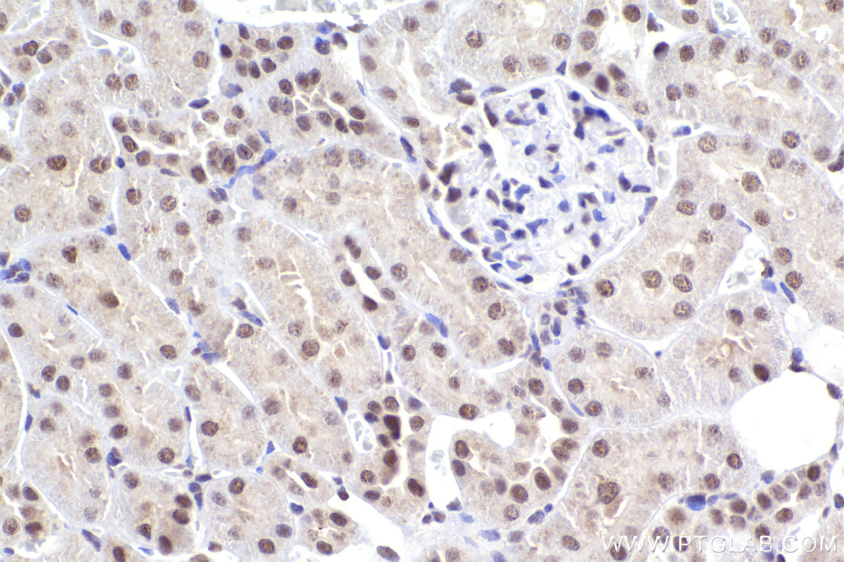 Immunohistochemical analysis of paraffin-embedded rat kidney tissue slide using KHC2210 (XPA IHC Kit).