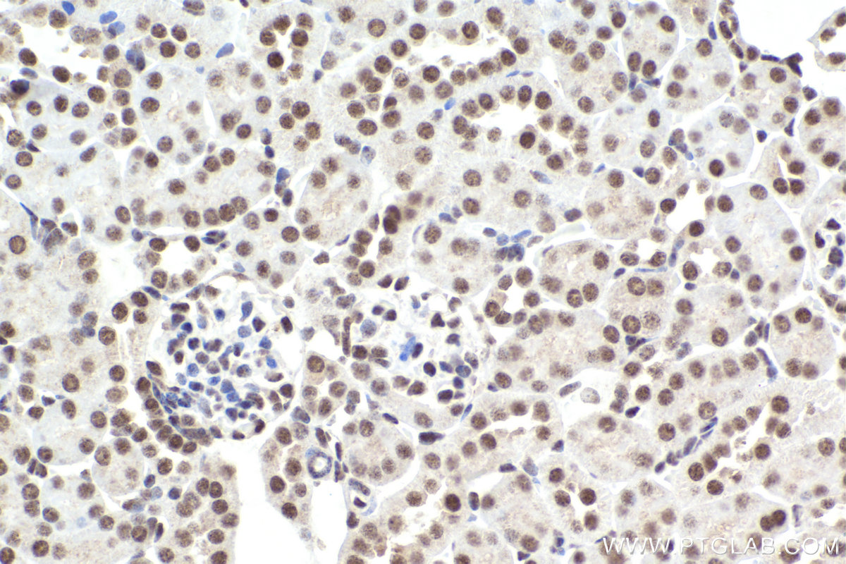 Immunohistochemical analysis of paraffin-embedded mouse kidney tissue slide using KHC2210 (XPA IHC Kit).