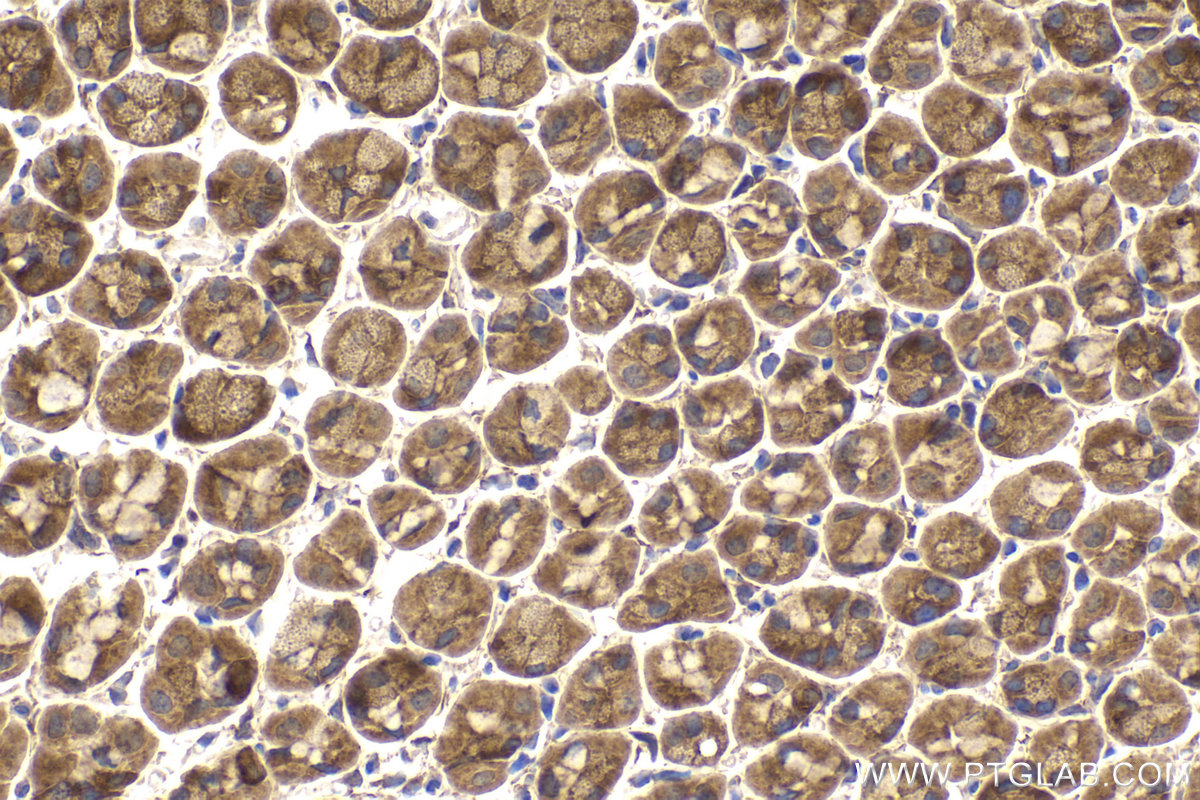 Immunohistochemical analysis of paraffin-embedded mouse stomach tissue slide using KHC2166 (YES1 IHC Kit).