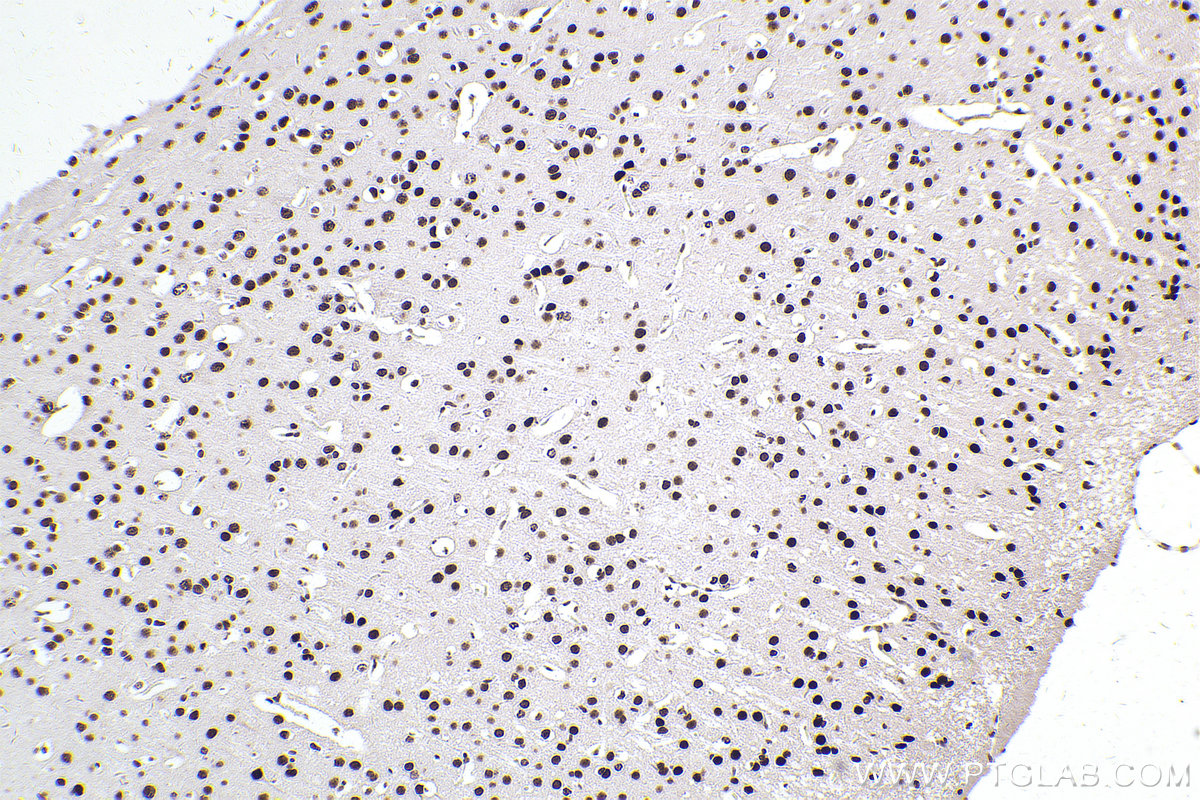 Immunohistochemical analysis of paraffin-embedded mouse brain tissue slide using KHC2550 (ZC3H13 IHC Kit).