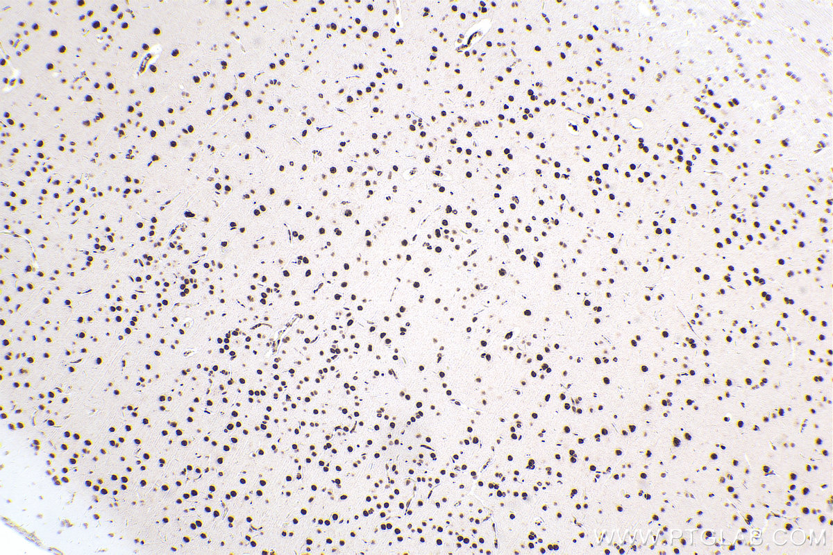 Immunohistochemical analysis of paraffin-embedded rat brain tissue slide using KHC2550 (ZC3H13 IHC Kit).