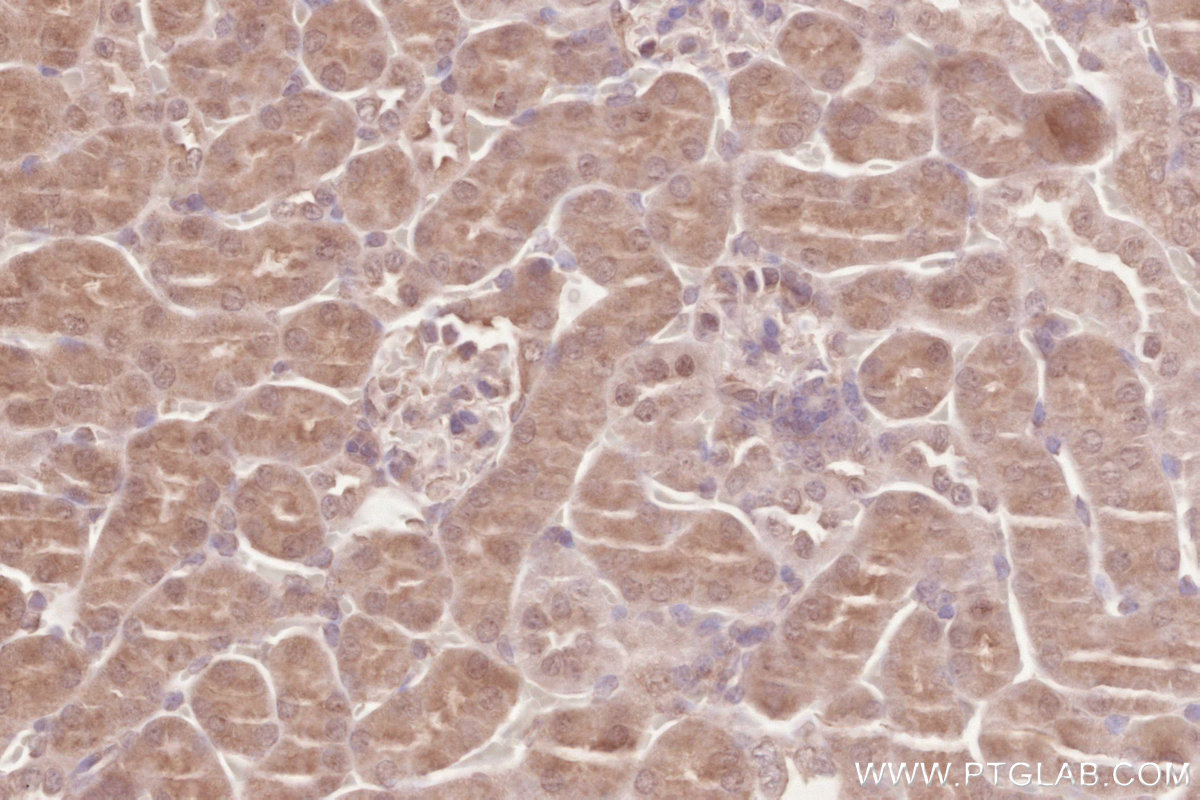 Immunohistochemical analysis of paraffin-embedded mouse kidney tissue slide using KHC2618 (ZC3HAV1 IHC Kit).