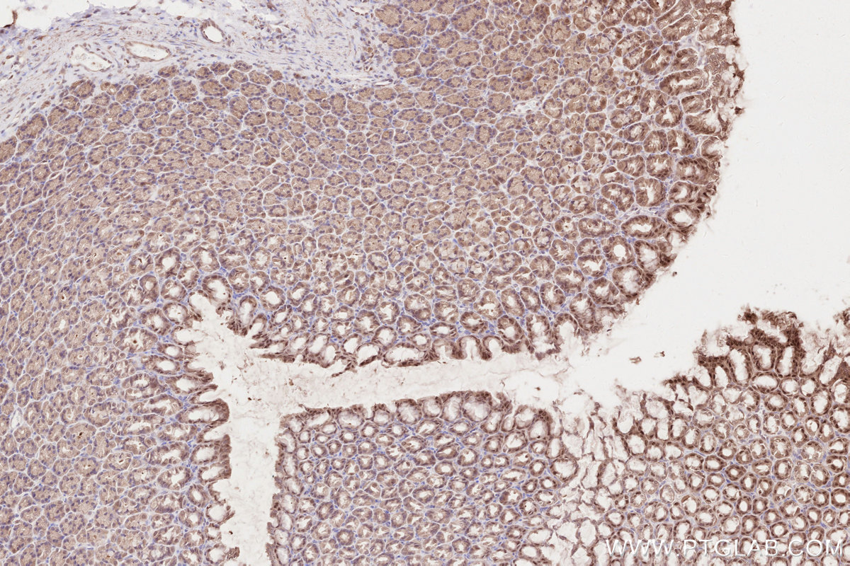 Immunohistochemical analysis of paraffin-embedded rat stomach tissue slide using KHC2618 (ZC3HAV1 IHC Kit).