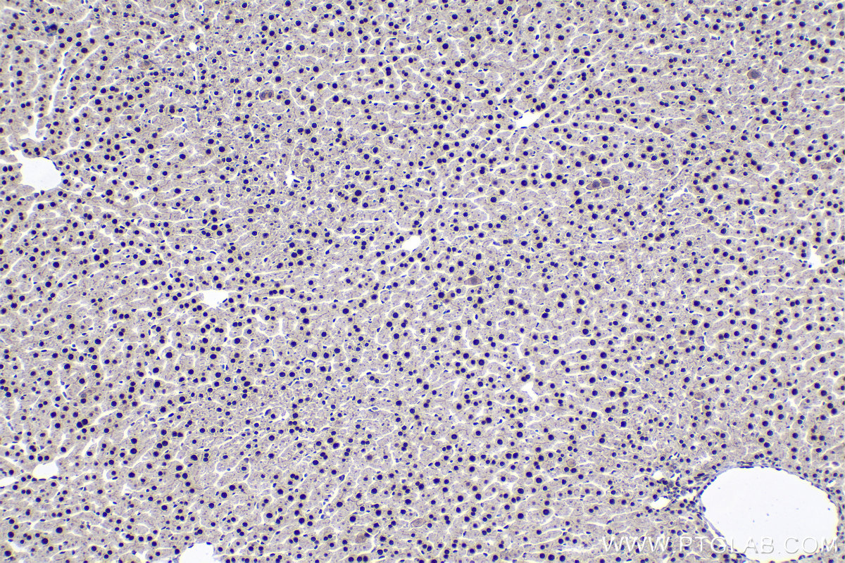 Immunohistochemical analysis of paraffin-embedded rat liver tissue slide using KHC1932 (ZHX3 IHC Kit).