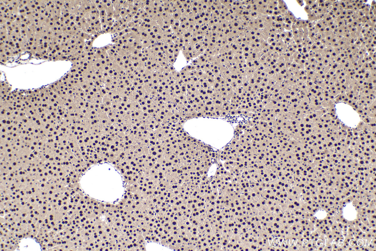 Immunohistochemical analysis of paraffin-embedded mouse liver tissue slide using KHC1932 (ZHX3 IHC Kit).