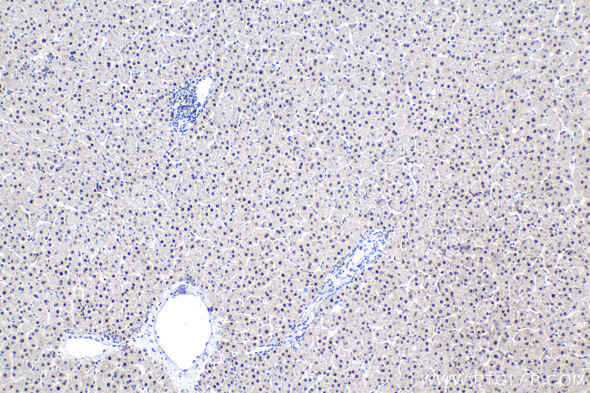 Immunohistochemical analysis of paraffin-embedded human liver tissue slide using KHC1932 (ZHX3 IHC Kit).