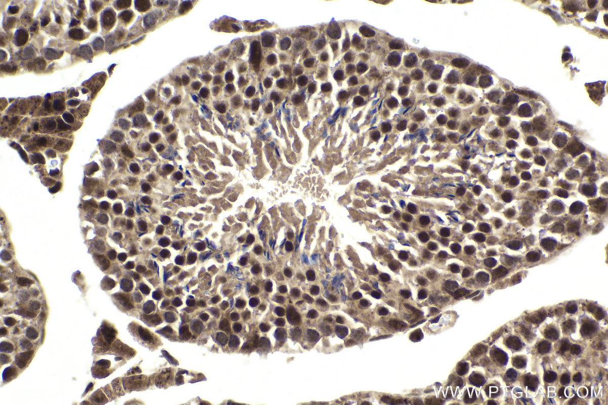 Immunohistochemical analysis of paraffin-embedded mouse testis tissue slide using KHC1997 (ZMIZ1 IHC Kit).