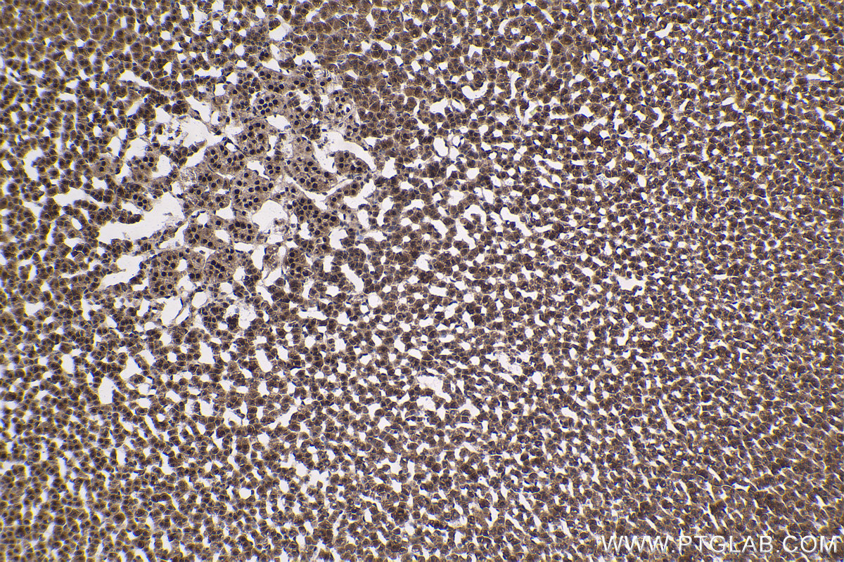 Immunohistochemical analysis of paraffin-embedded rat adrenal gland tissue slide using KHC1787 (ZNF746 IHC Kit).