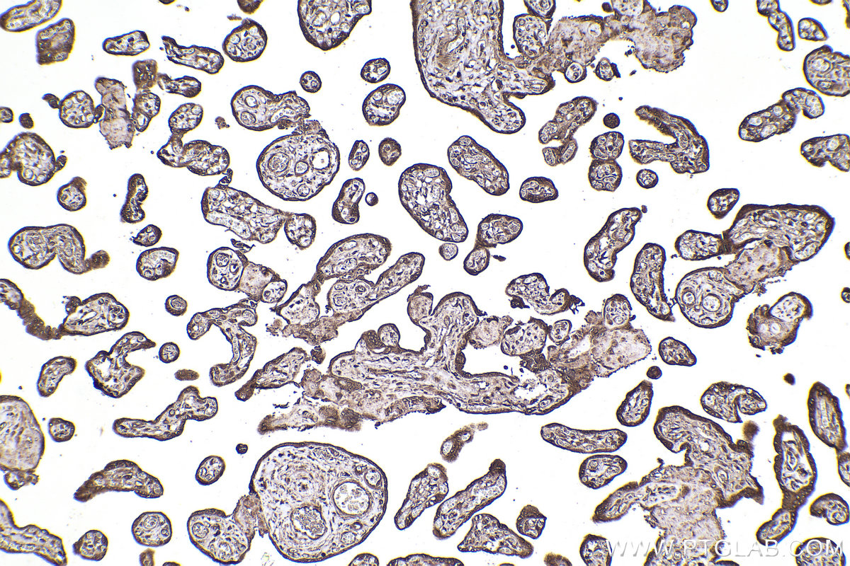 Immunohistochemical analysis of paraffin-embedded human placenta tissue slide using KHC2215 (CALR IHC Kit).