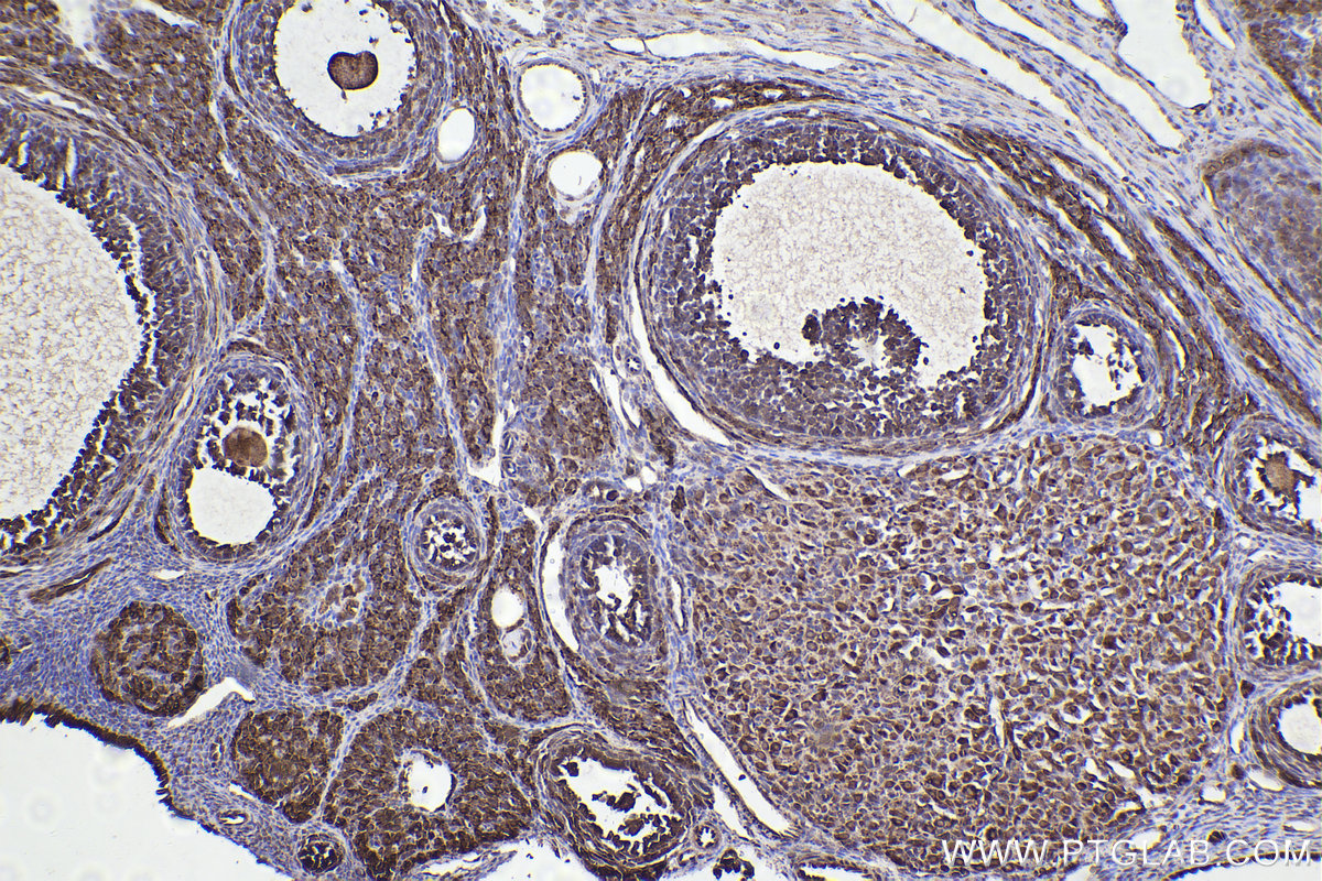 Immunohistochemical analysis of paraffin-embedded rat ovary tissue slide using KHC2215 (CALR IHC Kit).