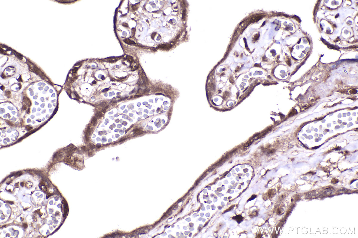 Immunohistochemical analysis of paraffin-embedded human placenta tissue slide using KHC2211 (RPS6KB1 IHC Kit).