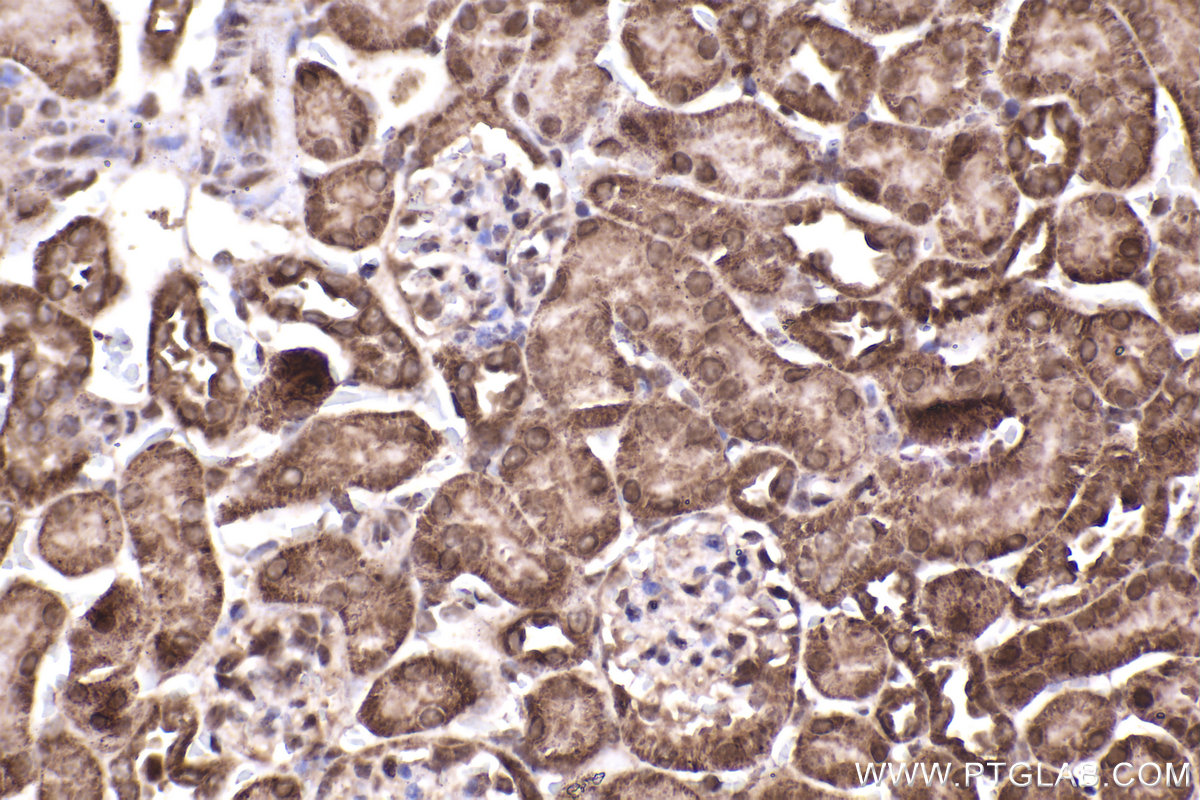 Immunohistochemical analysis of paraffin-embedded mouse kidney tissue slide using KHC2211 (RPS6KB1 IHC Kit).