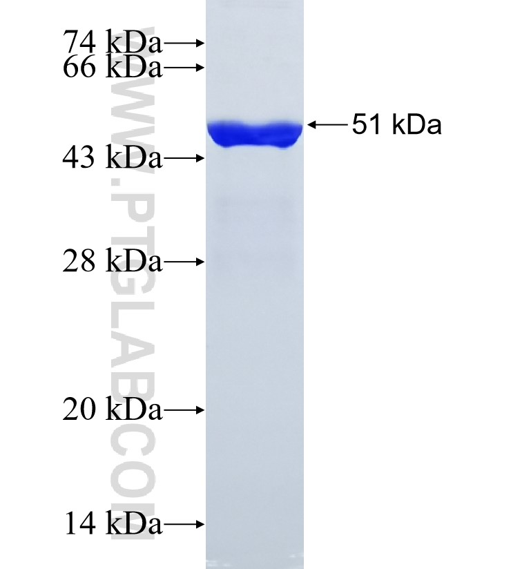 IKBKAP fusion protein Ag35286 SDS-PAGE