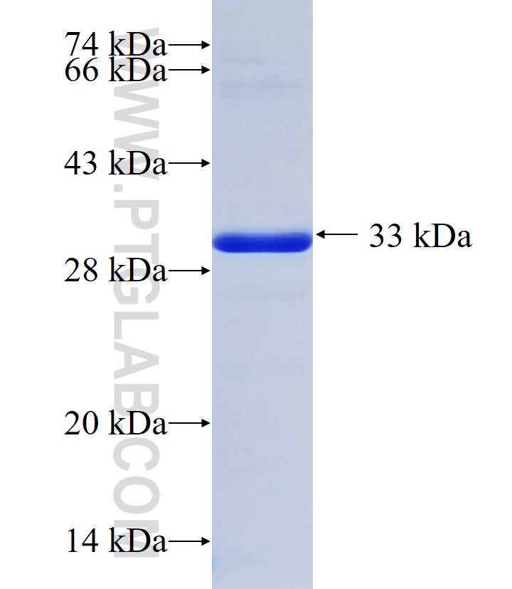 IKBKAP fusion protein Ag35332 SDS-PAGE