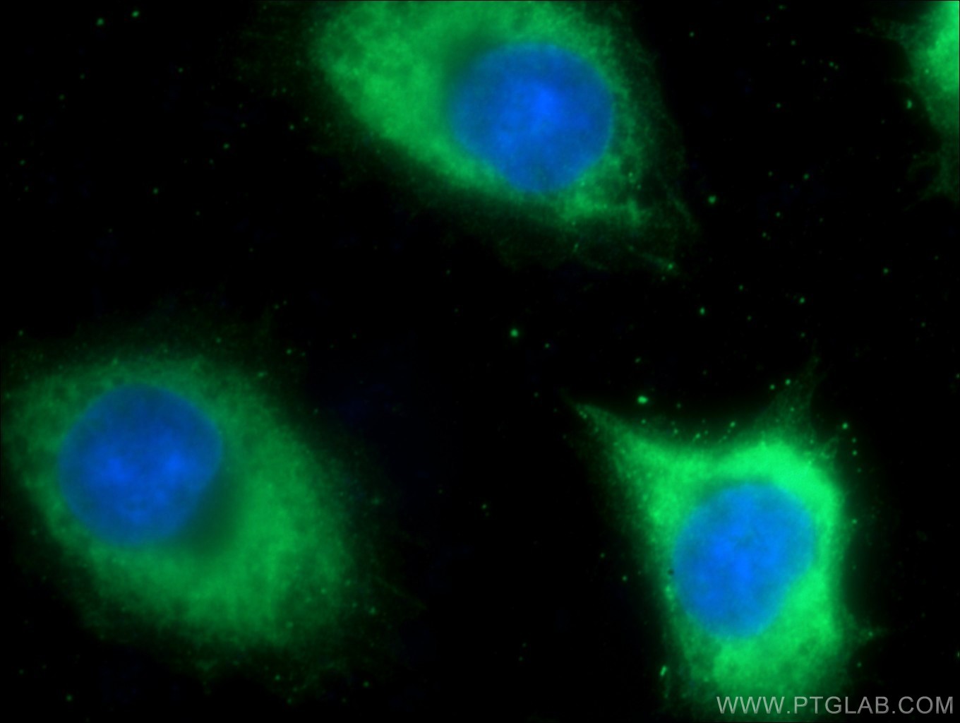 IF Staining of DU 145 using 20979-1-AP